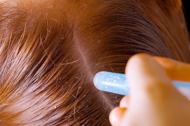 Tokyo Ginza Head Spa Trial：Scalp Care 75 — photo 18