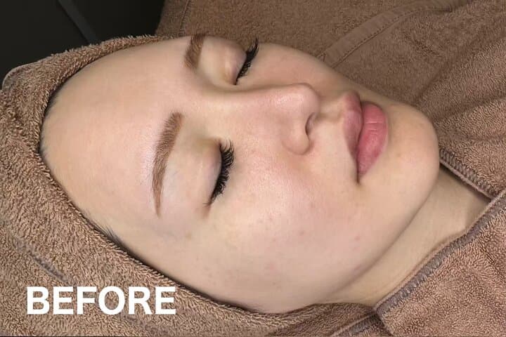 Tokyo 80-Minute Private Rejuvenating Facial with Pro Care Gift — photo 4