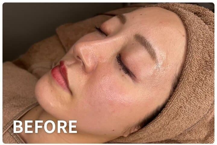 Tokyo 80-Minute Private Rejuvenating Facial with Pro Care Gift — photo 11