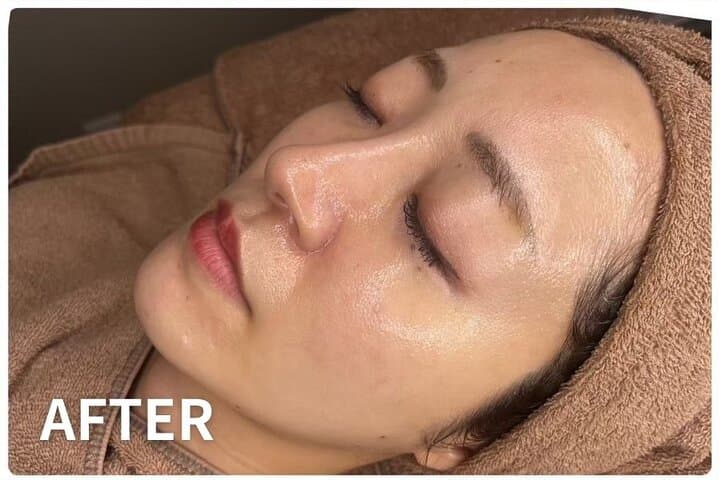 Tokyo 80-Minute Private Rejuvenating Facial with Pro Care Gift — photo 10