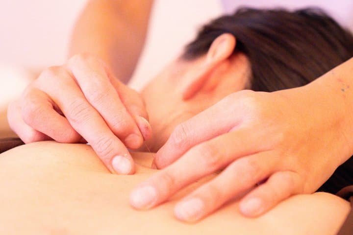 Japanese Acupuncture and Massage in Shibuya Tokyo Private — photo 3