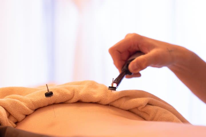 Japanese Acupuncture and Massage in Shibuya Tokyo Private — photo 6